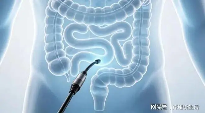 非必要不做肠镜？医生：只要做过肠镜，患者一定多加关注这4点！